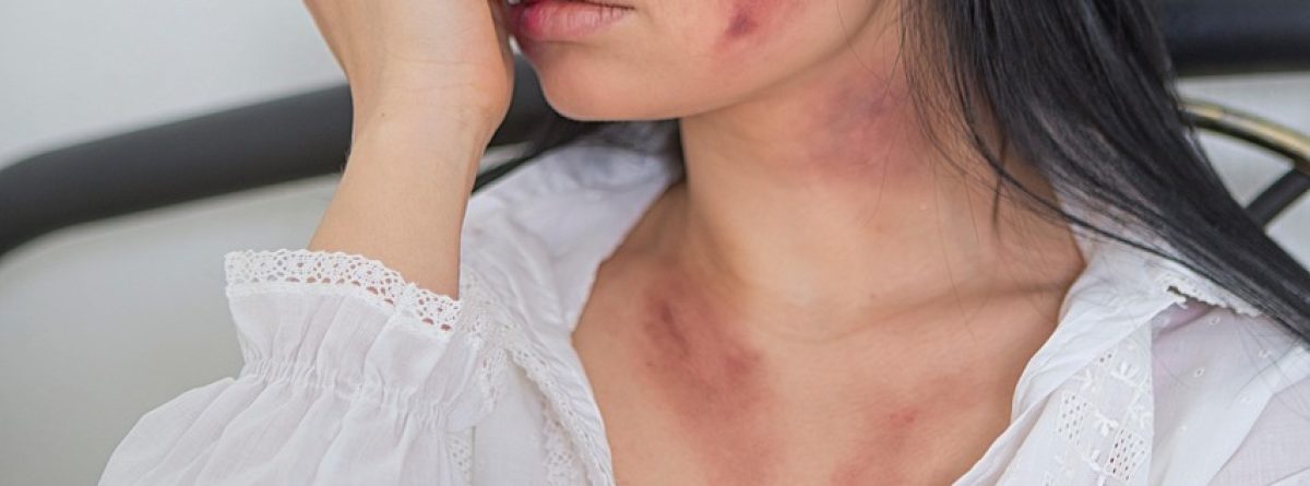 woman, bruise, domestic violence, harassment, hurt, pain, portrait